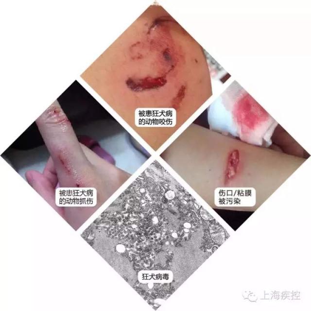 朋友圈疯传"男孩狂犬病发作学狗叫"!假的!