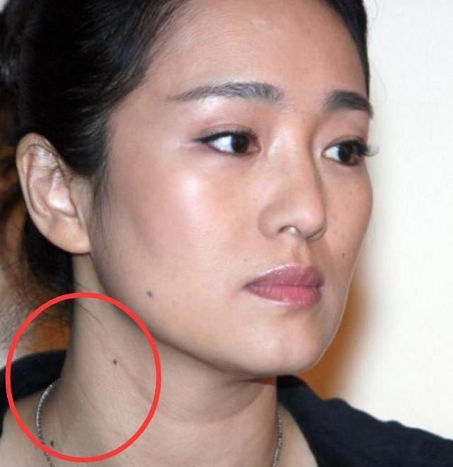 相关提示:女性脖子左侧有痣不是吉象,建议点掉. 四,痣长在锁骨上