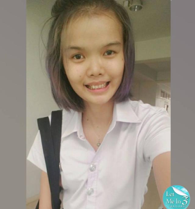 20岁女大学生因为丑被嘲笑,整容后变"芭比娃娃",网友评论炸了