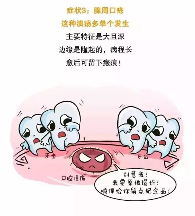 看知识学漫画,一张图带你全面了解口腔溃疡!二战图暴漫画走图片