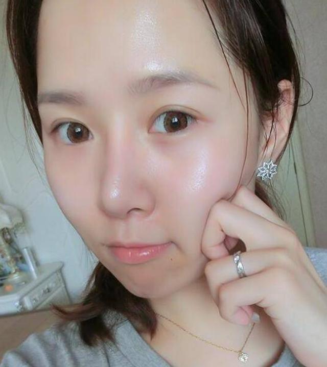 药店里国人瞧不起的国货乳膏,每天擦一擦,祛