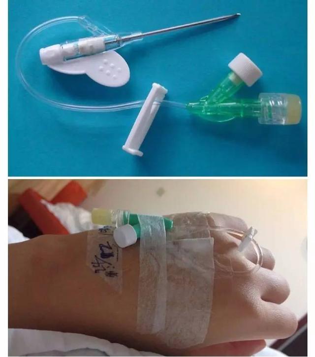静脉输液的原理是什么和什么高于什么(3)