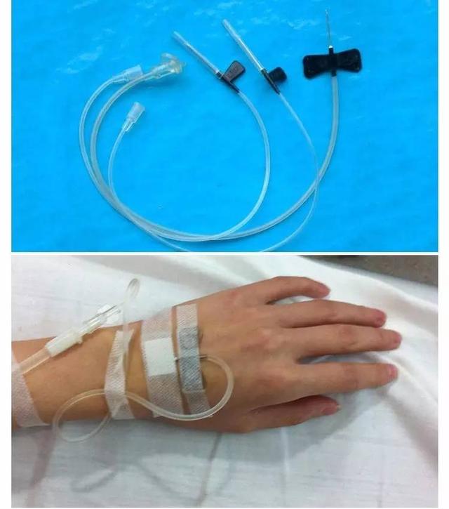输液时，用钢针or留置针?弄懂这点，孩子免伤害