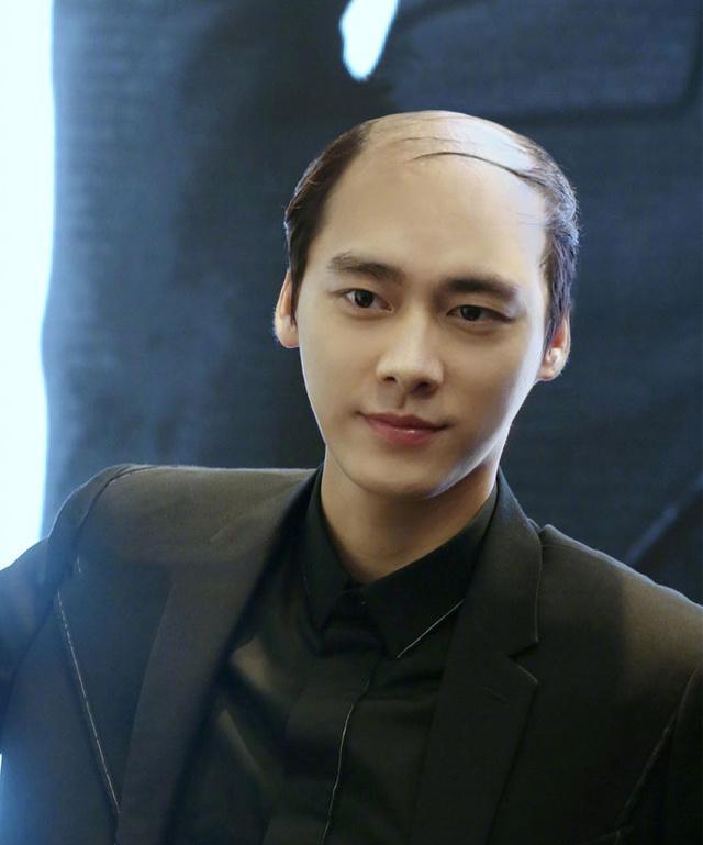 这六位明星脱发秃头 鹿晗变man了吴亦凡还不如光头