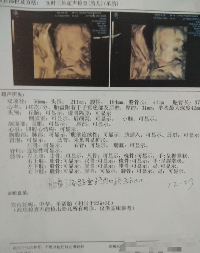 三维彩超图像与出生后的宝宝像吗？分享下我家宝贝的