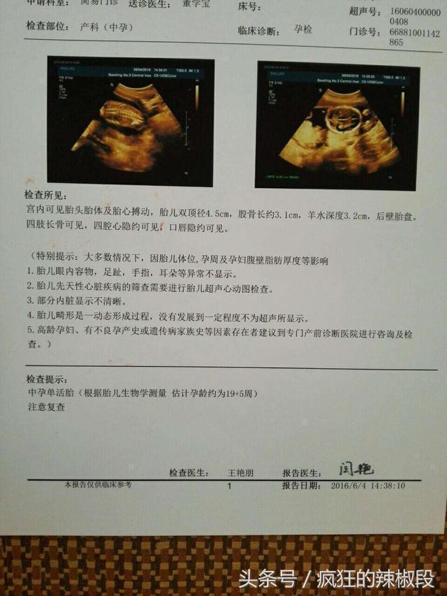 今天就和大家一起聊聊b超单数据怎么看?