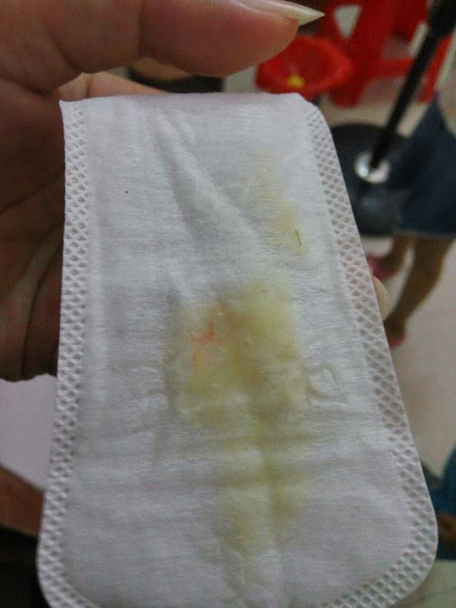 什么样的白带才算异常?白带异常的3个原因,第1个你绝对想不到