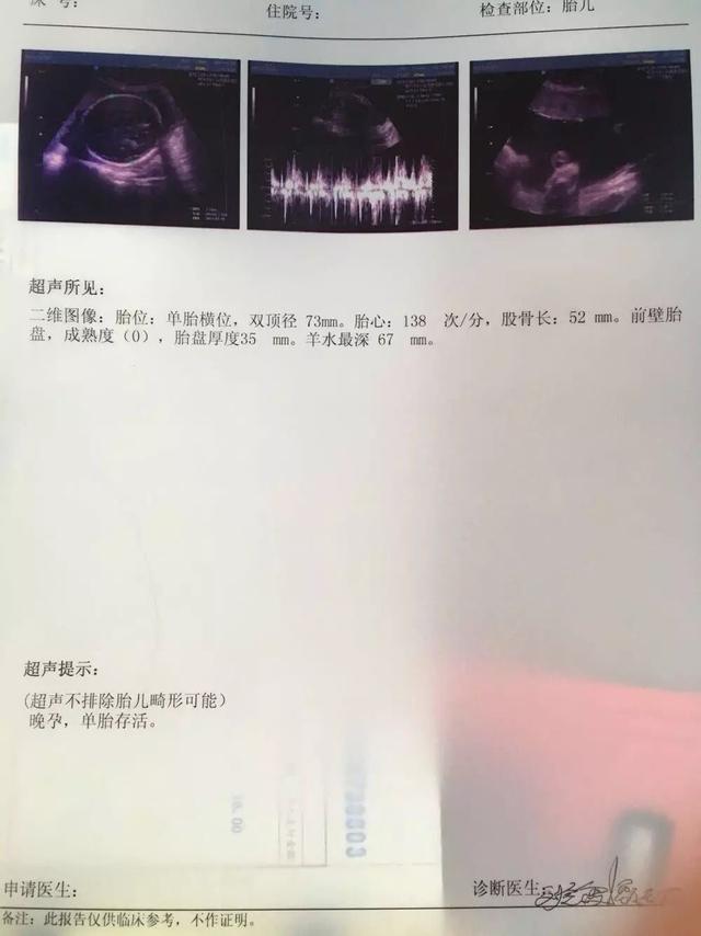 二胎b超图像已经确认男宝,简单谈谈这次症状!