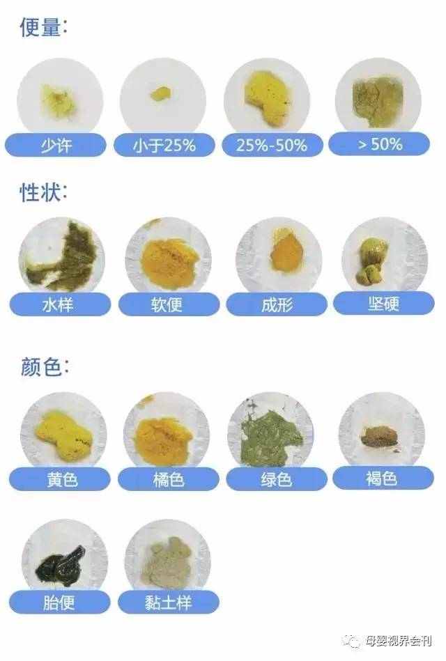 宝宝便便透露事实:看看宝宝肠胃消化好不好
