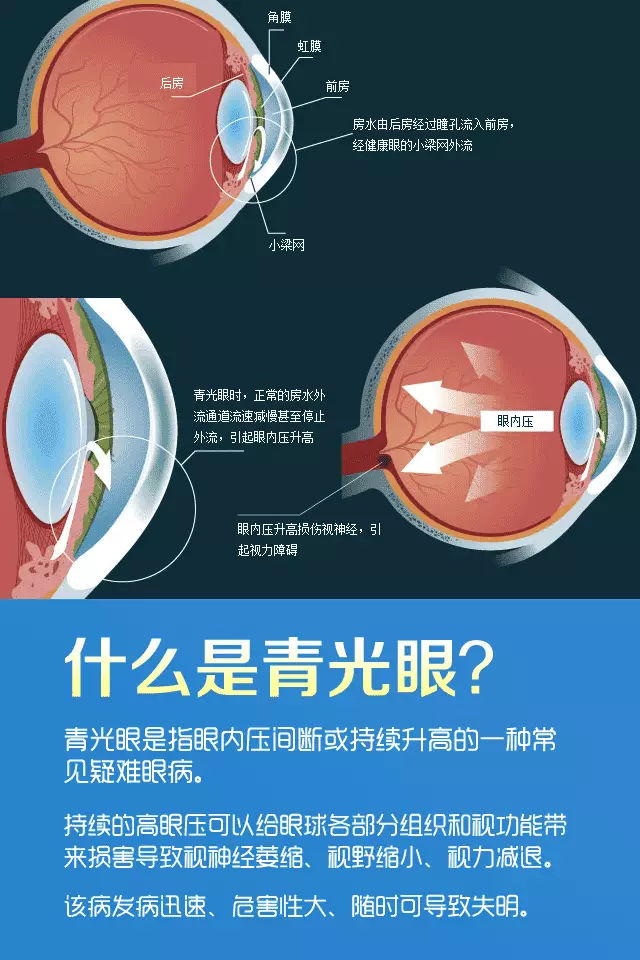 迎接世界青光眼周 南阳医专第一附属医院推出关爱青光眼患者活动