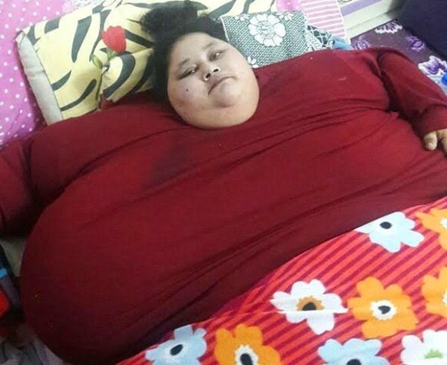 全球最胖的女人,体重1000斤,在床上整整躺了25年之久