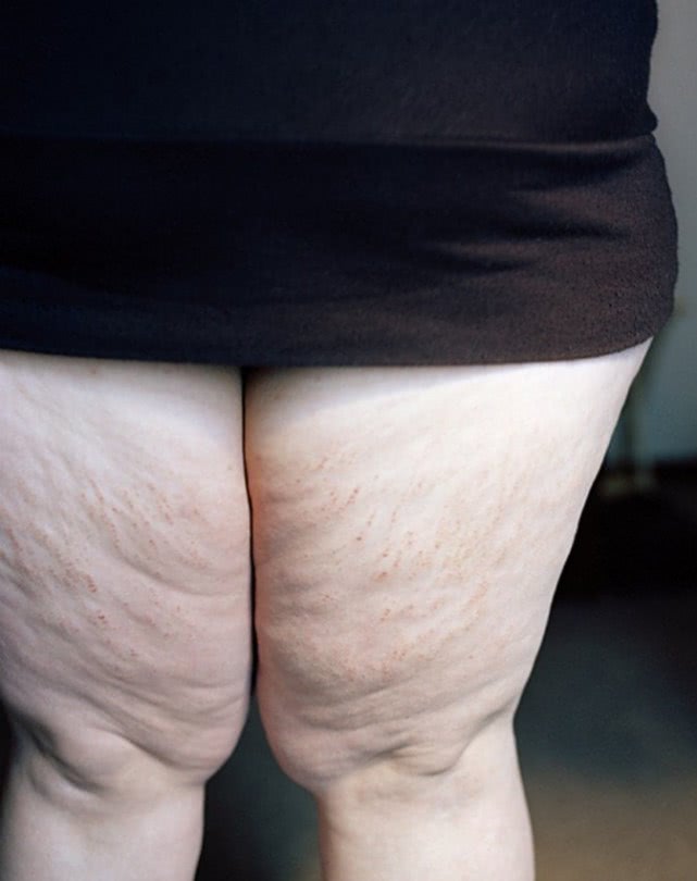 女胖子都找不到帅气的男朋友?别傻了，这位美国的胖女孩就是案列