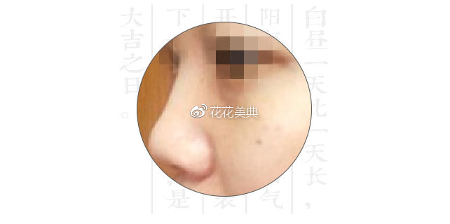 深度解析鼻子类型,测试你属于哪种鼻子?