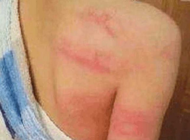 孩子身上满是伤痕没想到是这个人打的,父亲知道后想打人却被制止