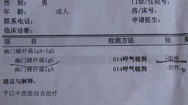 幽门螺旋杆菌怎么检查_胃幽门螺杆菌怎么检查