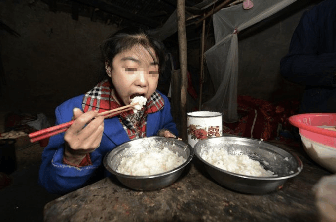 重庆女孩疑似饿鬼附体每天吃10斤米, 医生束手无策, 家里负担不起