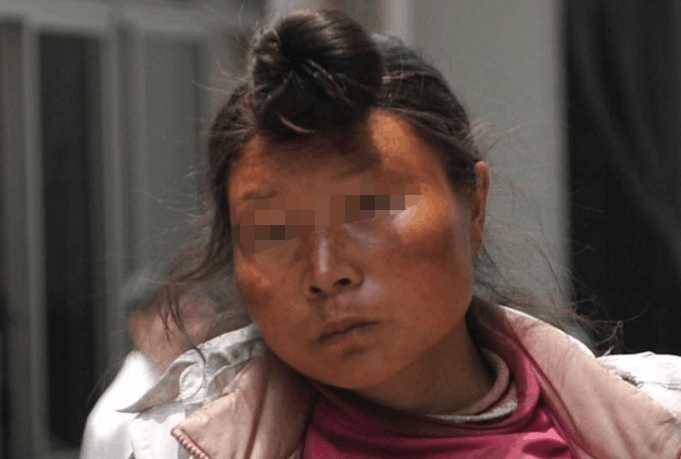 2岁女孩得了这个病,发病才3天就去世了,全家人