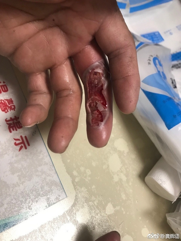 必须警惕！氢氟酸，剧毒，强腐蚀！