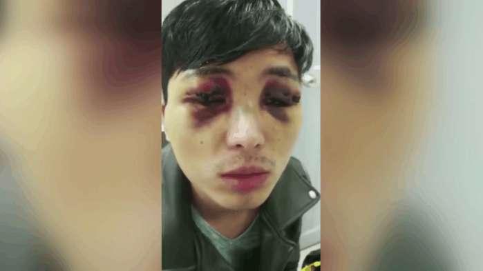 男人割皮的好处和坏处