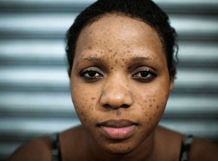 非洲美容院大量兴起, 只因黑人妇女的一个特殊