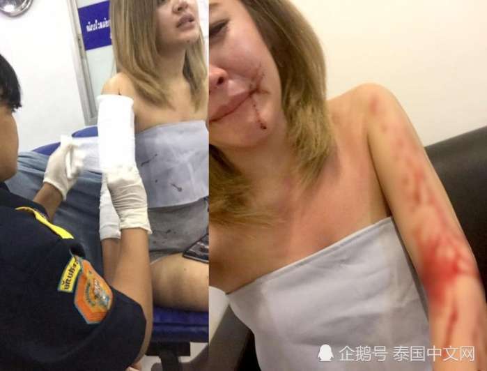 美女深夜打的被司机暴力抢劫, 全身被割43刀