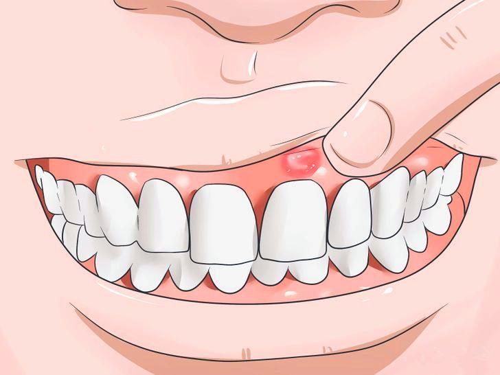 牙龈肿痛如何找上门?如何应对它?网友你的问题答案在这里!
