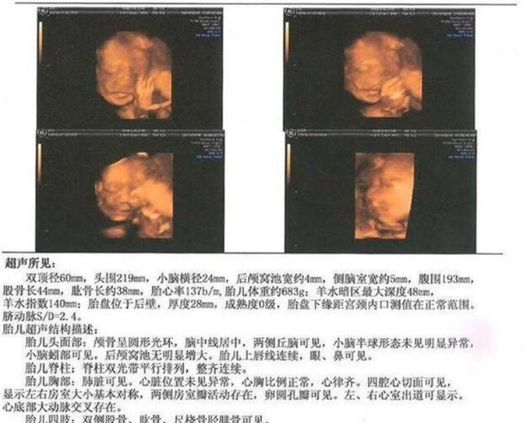 2次四维检查确认是男宝,孕期症状分享给大家!