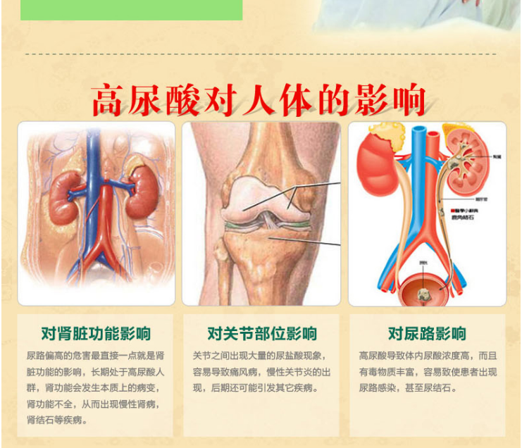 体检发现尿酸高怎么办?降酸饮食在这里,我来告