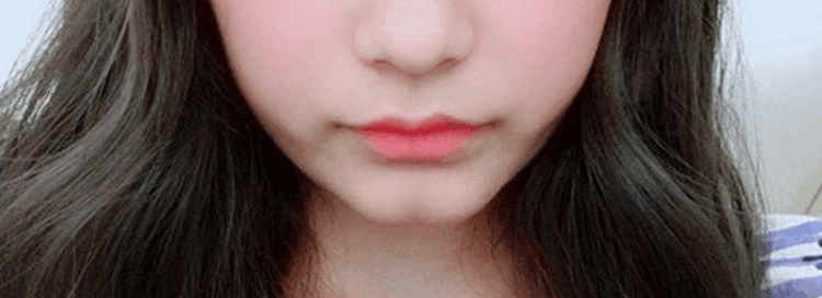 “屁股下巴”是什么? 锥子下巴已过时, 它才美得独特