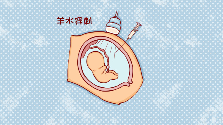 羊水穿刺有风险,但这5类孕妈必须得做