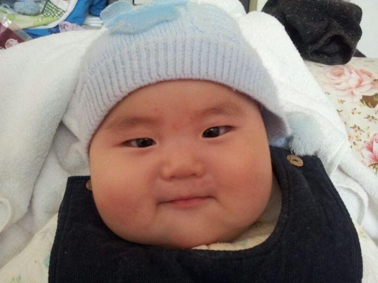 肥胖可导致多种健康危害