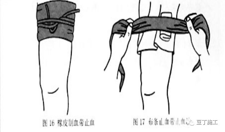 掌握这些建筑施工现场安全急救常识,关键时刻