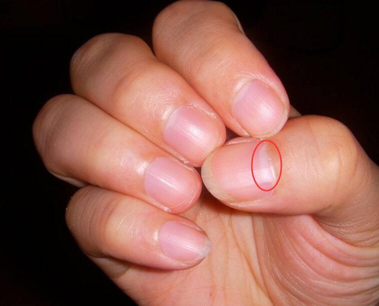 手指没有半月牙, 气血不足太严重, 一个古方补气