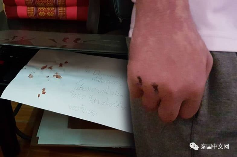 而厕所里的镜子也破了,估计是死者生前发泄而用手打破的.