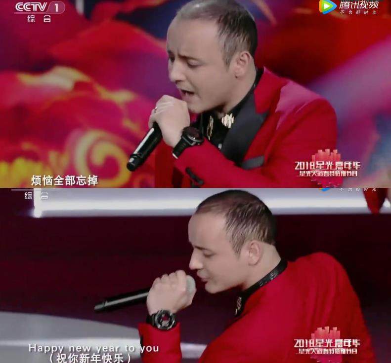 童星阿尔法年仅20就已秃顶引热议