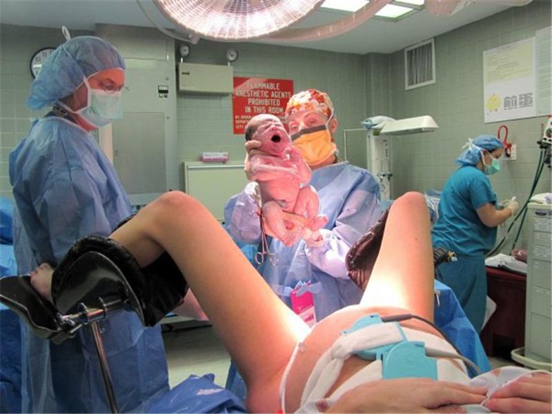 医生我是来生孩子的,不是来搞笑的,别逗好吗?