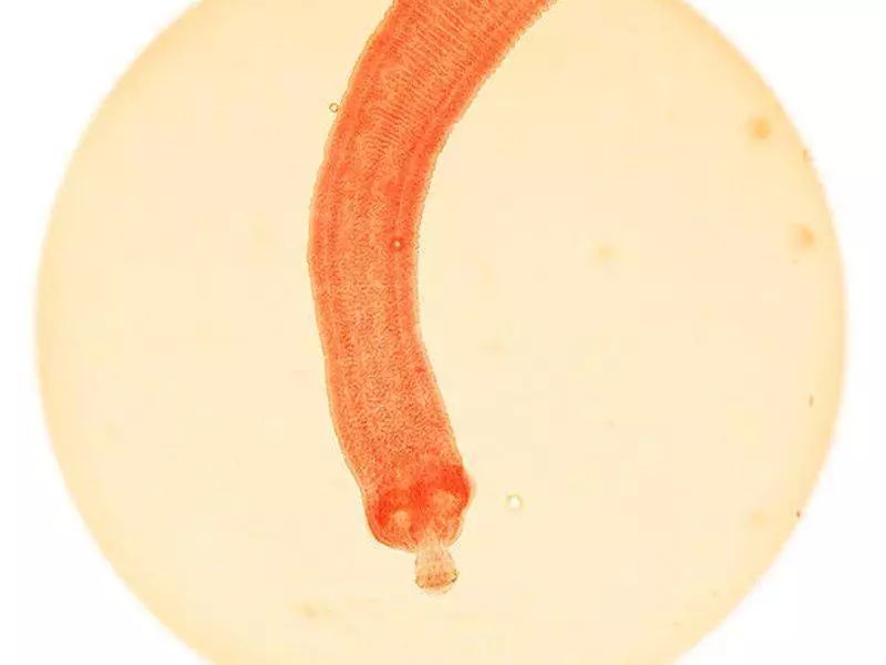 这15种最致命的动物,有些你一定想不到!