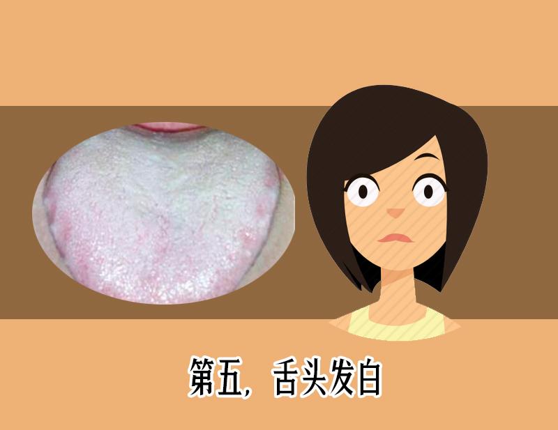 舌苔发红发黑是疾病警告?医生教你如何从舌头