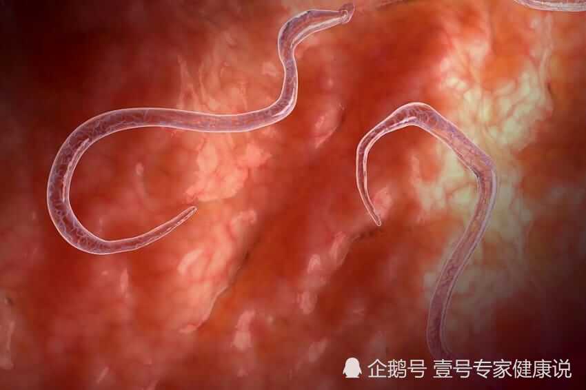 身体出现哪些症状,你应该小心体内有寄生虫?