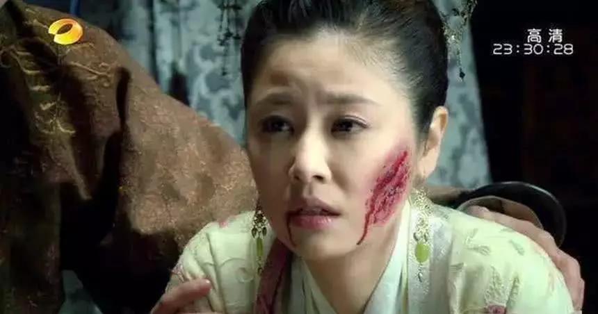 电视剧女星"毁容"谁最惨?赵丽颖却还是很美,她连自己看了都怕
