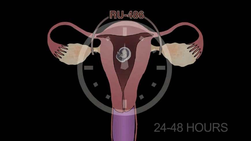 无痛人流真的不痛吗? 看完这几种胎儿的死法,