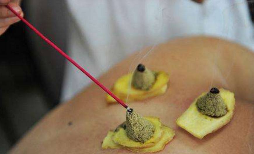 鼻炎、过敏性鼻炎,睡前艾灸这里几分钟,简单不