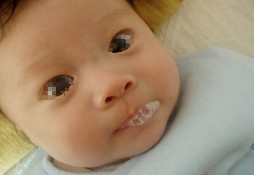 遇到孩子吐泡泡,非常值得看的一篇文章