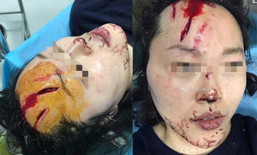陕西女孩被家暴,告诉你这样的男人不能嫁!