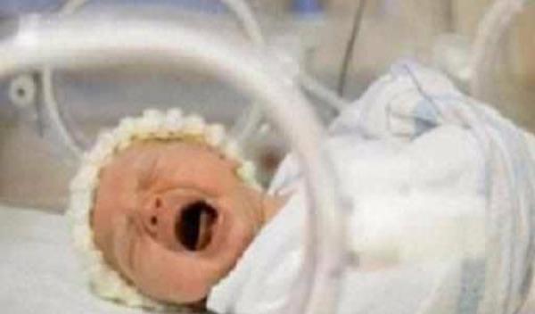 新手妈妈的教训:未满月小宝宝黄疸变脑瘫,只因