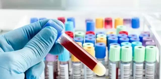 唐筛vs糖筛vs糖耐有什么区别,准妈们一定要做