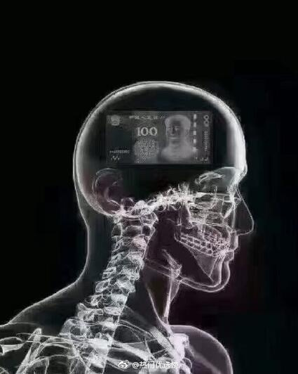 这几天一直头疼,就去医院拍了个脑CT,终于找到