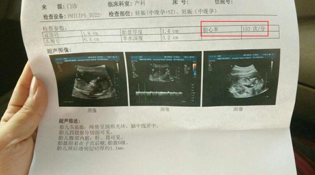 孕检时如果有这些情况,说明怀男宝的几率很高哦