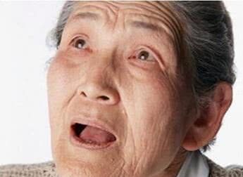 一旦面部出现4种特征,这三类人要警惕脑梗塞,