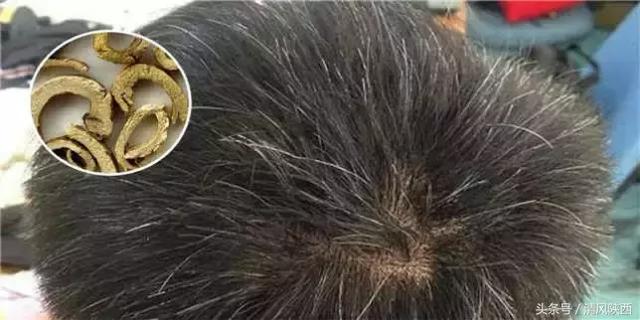 山西临县泰业煤矿为何瞒报一死安全生产事故？